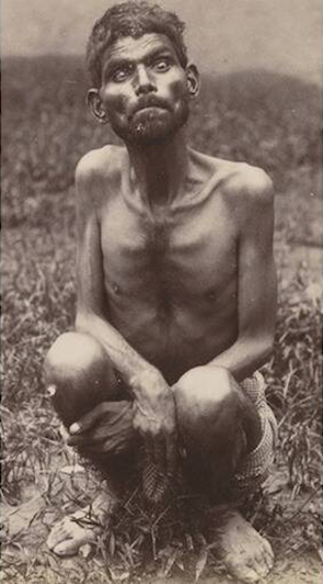 Feral Children - Dina Sanichar